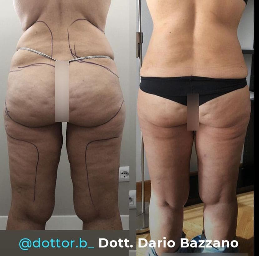 prima e dopo 39